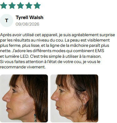 avis 2 Image